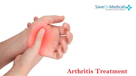 What Are The Complications Of Arthritis Arthritis