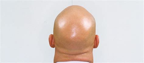 Why Are Bald Heads So Shiny When The Skin Elsewhere On Your Body Isnt