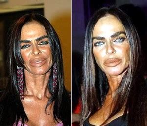 Michaela Romanini Plastic Surgery Before And After Pictures