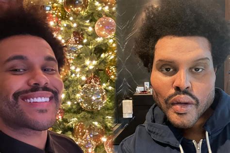 The Weeknds Latest Selfie Makes Fans Ask What Happened To His Face