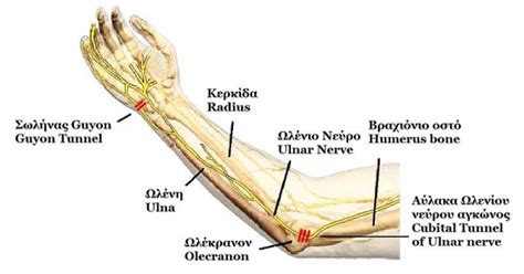 Ulnar Nerve Entrapment Physiopedia