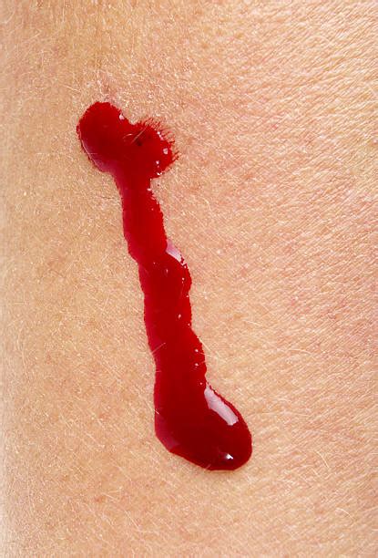 Top 60 Blood On Skin Stock Photos Pictures And Images Istock