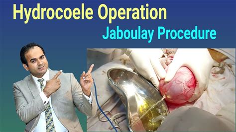 Hydrocoele Operation Jaboulay Procedure Hydrocoelectomy Surgeon Dr Imtiaz Hussain YouTube