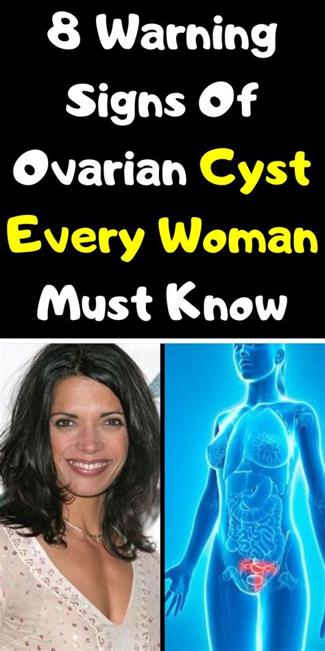 8 Warning Signs Of Ovarian Cyst Every Woman Must Know Signs Of