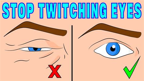 How To Fix Twitching Eyes In Under 4 Minutes Youtube