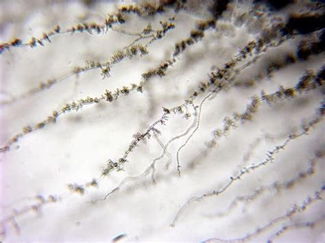 Fun With Microbiology Whats Buggin You Aureobasidium Pullans