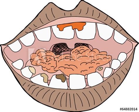 Eat Clipart Mouth Full Food Eat Mouth Full Food Transparent Free For
