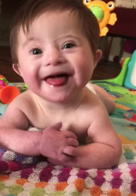Adopted Baby With Down Syndrome Melts Hearts Everywhere Faithpot