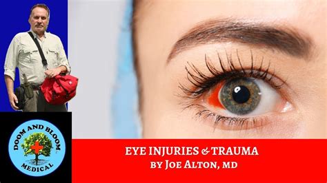 Eye Injury First Aid