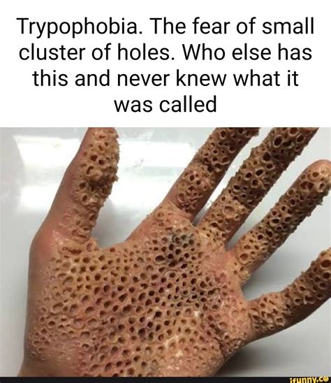 Trypophobia Skin Meme