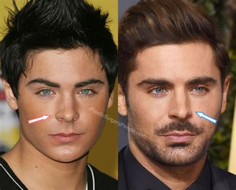 Zac Efron Before And After 2020
