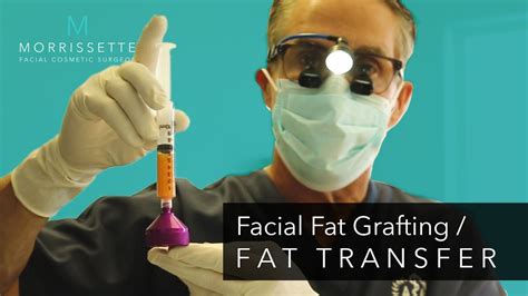 Facial Fat Grafting Ventura And Oxnard Dr Morrissette