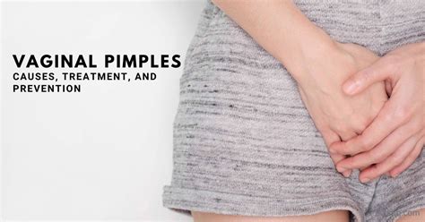 Genital Pimples Causes Symptoms Treatment And Prevention Faqs