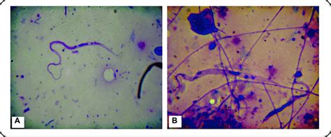 A And B Epimastigote Form Of Trypanosoma Rangeli At 1600x Magnifi Download Scientific Diagram