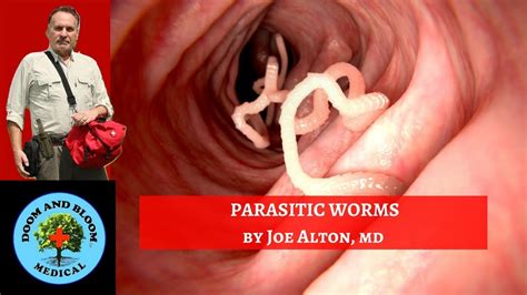 Parasitic Worm Infections Part 1 Youtube
