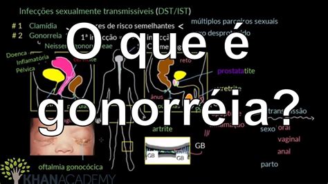 Entenda a gonorréia sintomas tratamento e prevenção