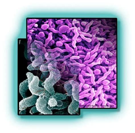 Campylobacter Jejuni Disease Properties Lab Diagnosis Microbe Online