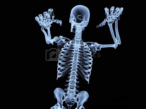 Xray Skeleton