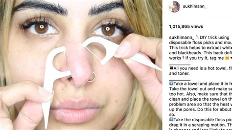 The Way This Woman Uses Floss To Remove Her Blackheads Is Unreal Glamour