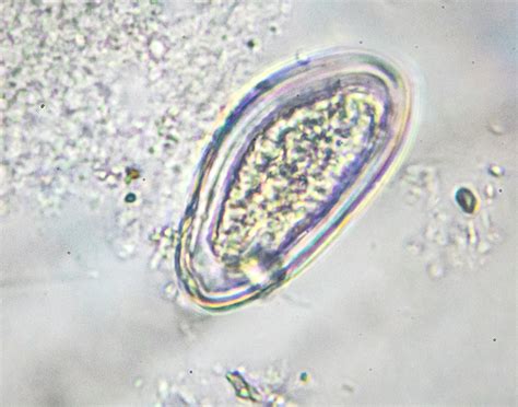 Pinworm Test