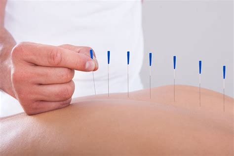 How Does Acupuncture Boost The Immune System Lok Acupuncture Clinic Ltd