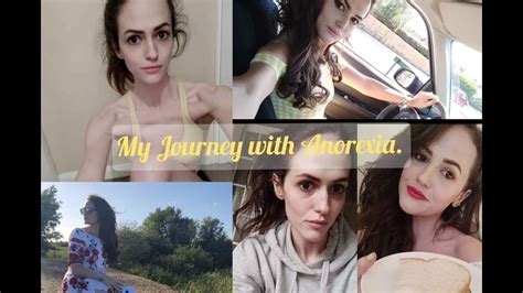 My Anorexia Journey Again Youtube