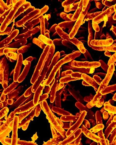Mycobacterium Tuberculosis Howmed