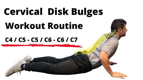 Workout Routine For Cervical Disc Bulges Beginner Level Youtube