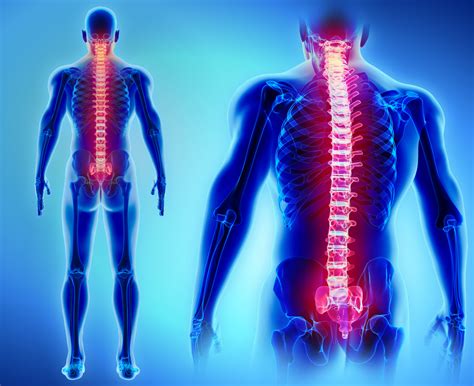 What Is Dorsal Root Ganglion Stimulation Southeast Pain And Spine Care