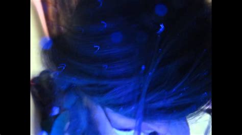Dandruff under Wood's Lamp - YouTube