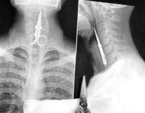 20 Craziest X Ray Images