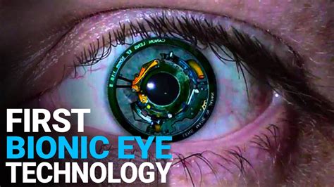 The Worlds First Bionic Eye Will Cure Blindness New Technologies