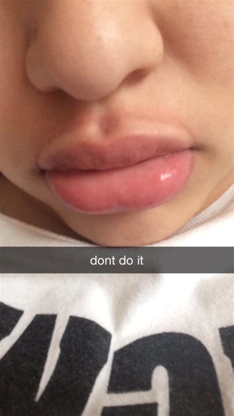 Kylie Jenner Challenge Is Invading Social Media Celebrific