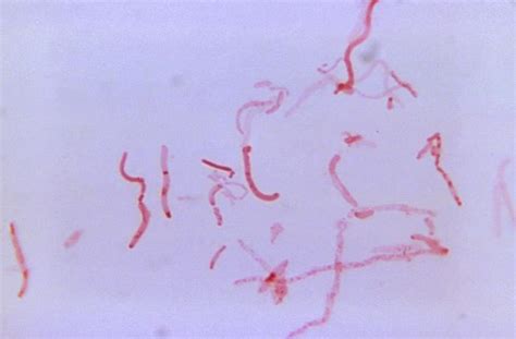 Gram Negative Bacilli Rods Microbiology Learning The Whyology Of