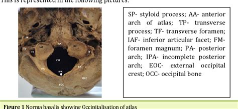 Figure 1 From Occipitalisation Of Atlas Vertebra And Its Clinical