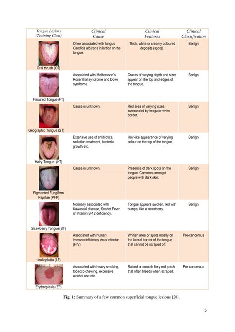 Automated Detection Of Oral Pre Cancerous Tongue Lesions Using Deep