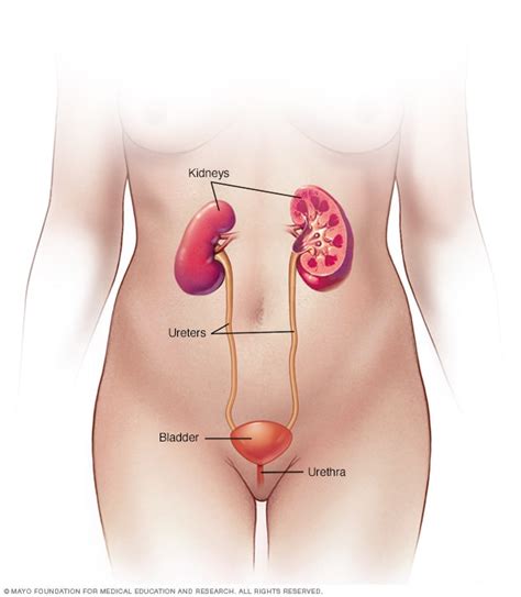 A urinary tract infection is an infection of any part of the urinary tract, which includes the bladder, kidneys, ureters and urethra. Blood in urine (hematuria) - Symptoms and causes - Mayo Clinic