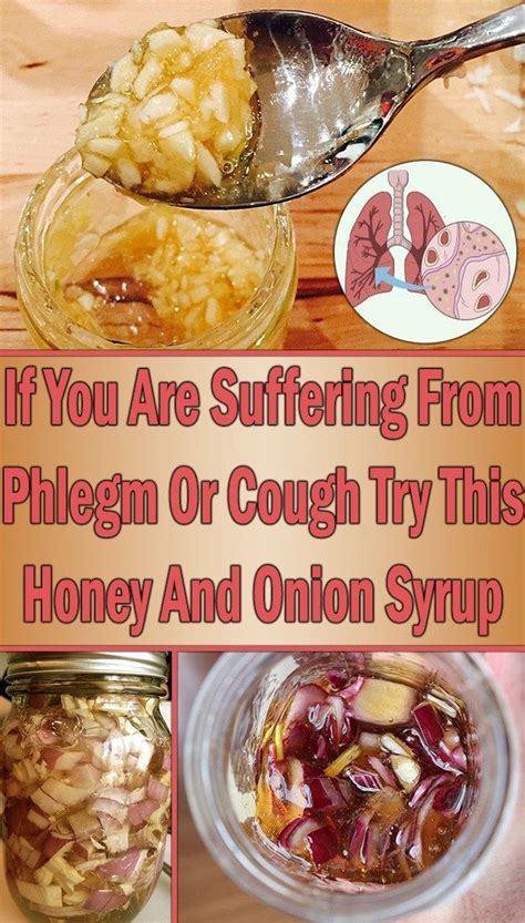 Honey And Onion Cough Syrup Recipe