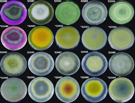 Colony Features Of The Fungi Isolated On Potato Dextrose Agar Plate