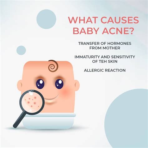 What Causes Baby Acne And What Can You Do About It The Butterfly