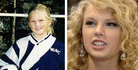 32 Taylor Swift Teeth Veneers Images