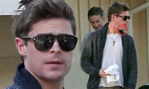zac efron displays swollen face and large scar on his chin after accident which saw his jaw