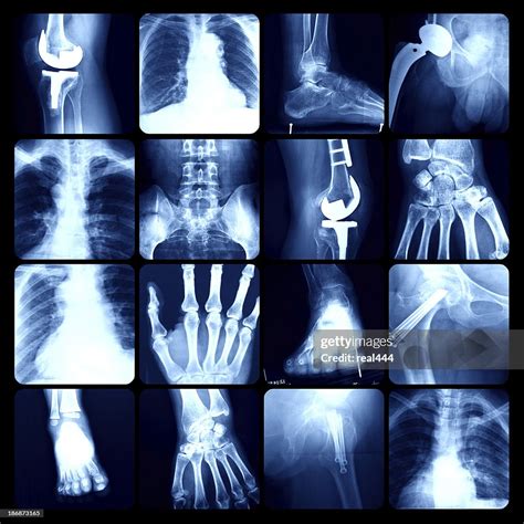 Xray High Res Stock Photo Getty Images