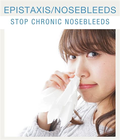 Nosebleeds Causes And Treatments Ent In Stamford Ct