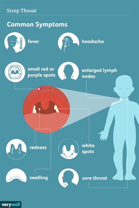 Symptome Von Strep Throat
