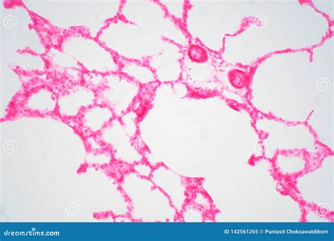 Human Lung Tissue Under Microscope View Stock Image Image Of Medicine
