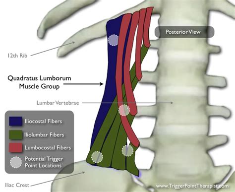Quadratus Lumborum Trigger Points Masters Of Low Back Pain