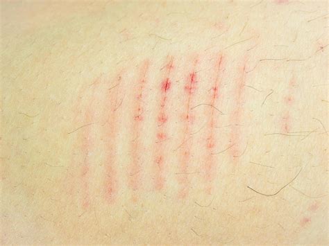 Close Up Scar Scratch On The Human Body 3670753 Stock Photo At Vecteezy