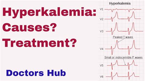 Causes Diagnosis And Treatment Of Severe Hyperkalemia Youtube