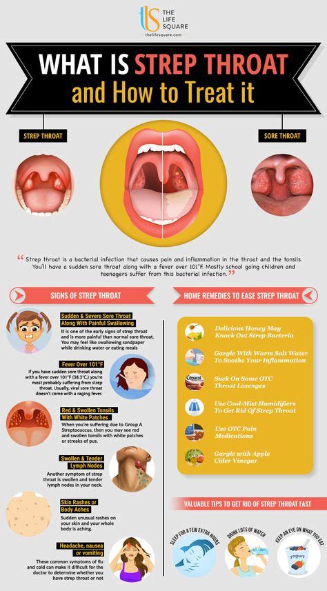 Pin Von Tri City Dental Auf Dental Infographics Strep Throat Strep